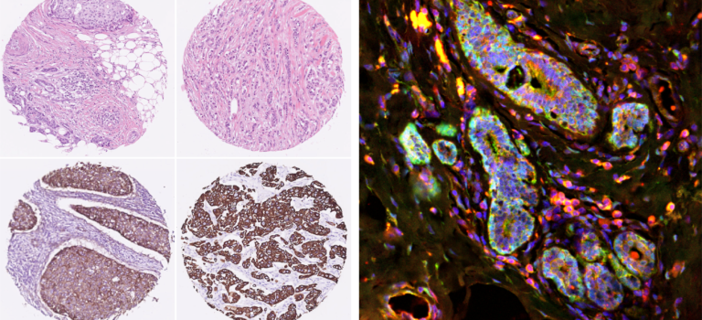 Project stories: interview with Thijs Koorman