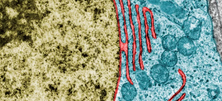 Research uncovers how damaged nucleus re-seals and repairs itself